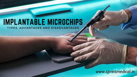 current uses for rfid chips in humans|Microchips in humans: consumer.